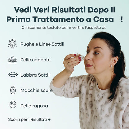 Velora™ - Siero Micro Infusione