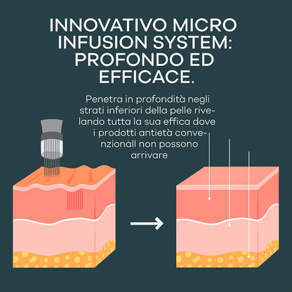 Velora™ - Siero Micro Infusione