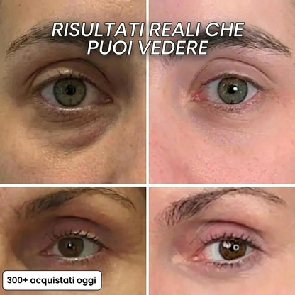 Stick Rimpolpante Intensivo al Collagene